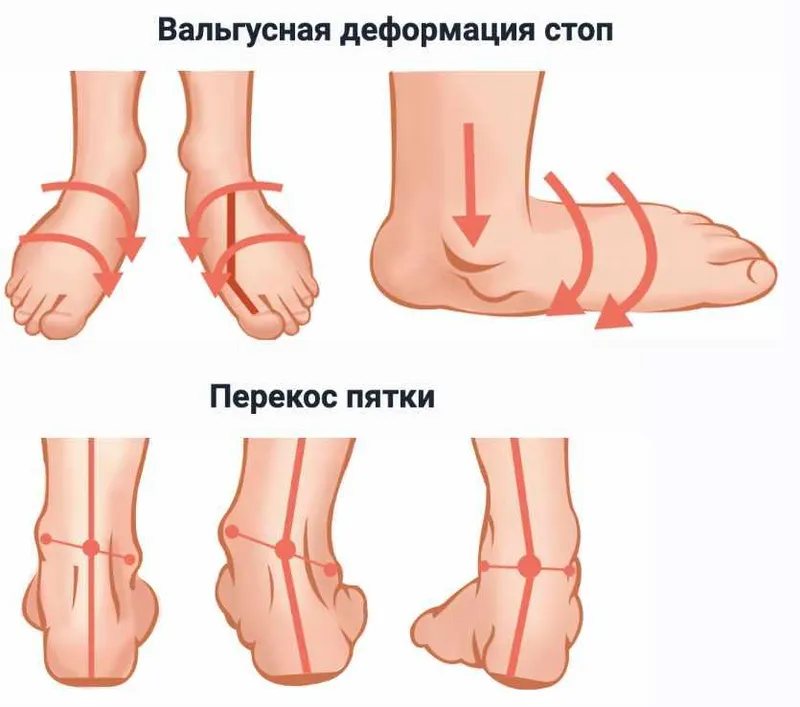 Обложка курса «Стопа. Инструкция по применению»