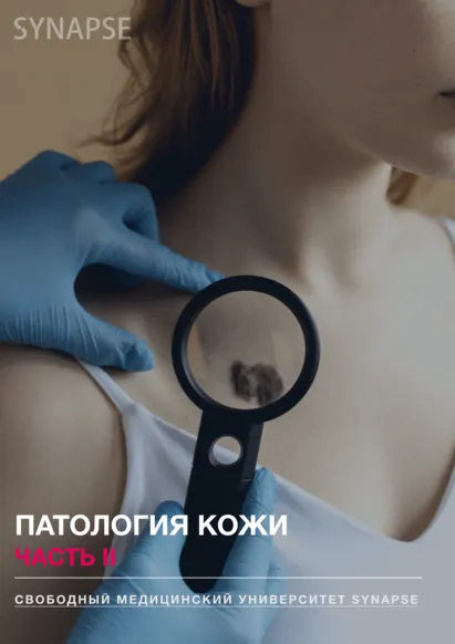 Обложка курса «[Synapse] Методичка по патологии кожи. Часть II»